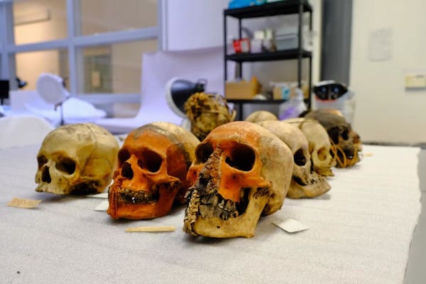 牛津大学皮特里弗斯博物馆收藏的人类遗骸