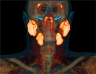 新发现的管状唾液腺：一个具有放疗风险的潜在新器官。