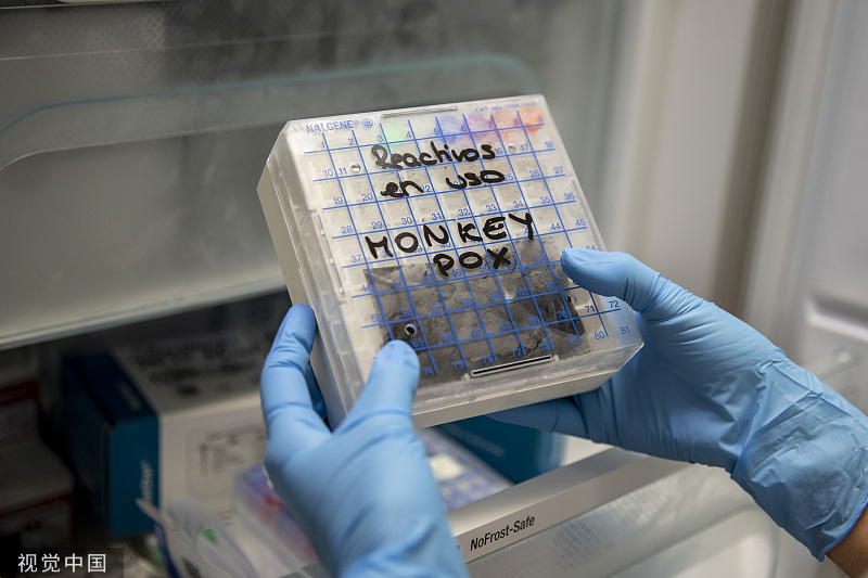 技术人员正对疑似猴痘样本进行检测。人民视觉 图