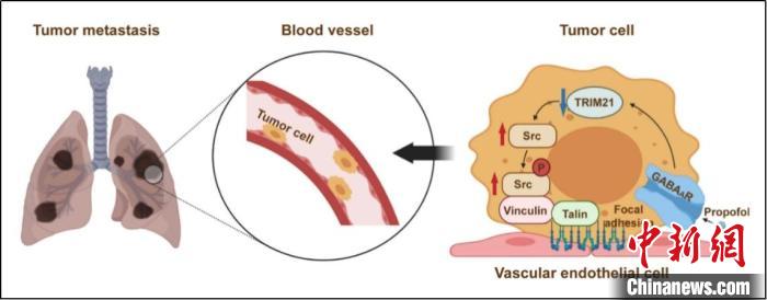 丙泊酚能使更多的肿瘤细胞黏附到血管内皮细胞。　研究示意图 摄
