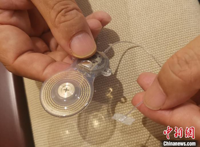 在3*5.5mm柔性材料上密布着16个用以刺激耳蜗核的听觉神经元。 奚荣佩 摄 在3*5.5mm柔性材料上密布着16个用以刺激耳蜗核的听觉神经元。 奚荣佩 摄